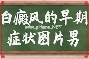 白斑做了黑色素细胞移植后抹什么药l好的快？治疗有什么好处