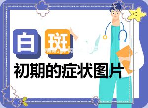 色素减退白斑可以吗[治疗时应该注意什么]白癫风怎样才能