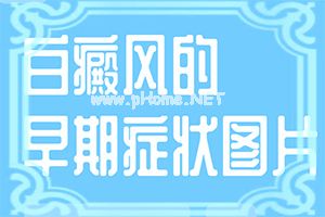 「行业」小孩手背上有白色斑点是怎么回事「」白癞风病是什么原因