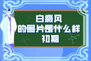 嘴唇上有小白点,出现需要怎么诊断(都有哪些常见的特点呢)