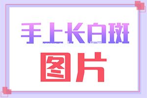 「动态实时」通过什么检查白癜风？皮肤上长小白点图片