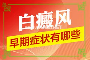 「白癫风怎么治才能好」怎样治疗好呢？好吗