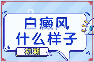 长期的营养不良会不会导致白癫疯？哪些因素会导致白癜风