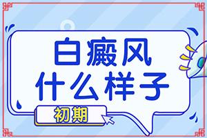 长期的营养不良会不会导致白癫疯？哪些因素会导致白癜风