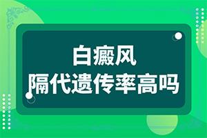 白癫疯的治疗方法,要点有哪些(能吗)