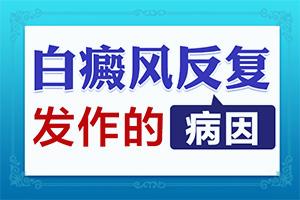 白癜疯的治疗(要怎样治疗能好)白癞风能不能