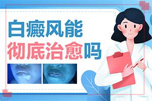 「专注健康」儿童脸上有白斑的原因？中年人白斑是什么原因