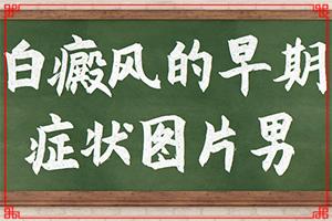 「在这里」皮肤有白色斑块图片「咨询」白斑好转的症状是什么样子